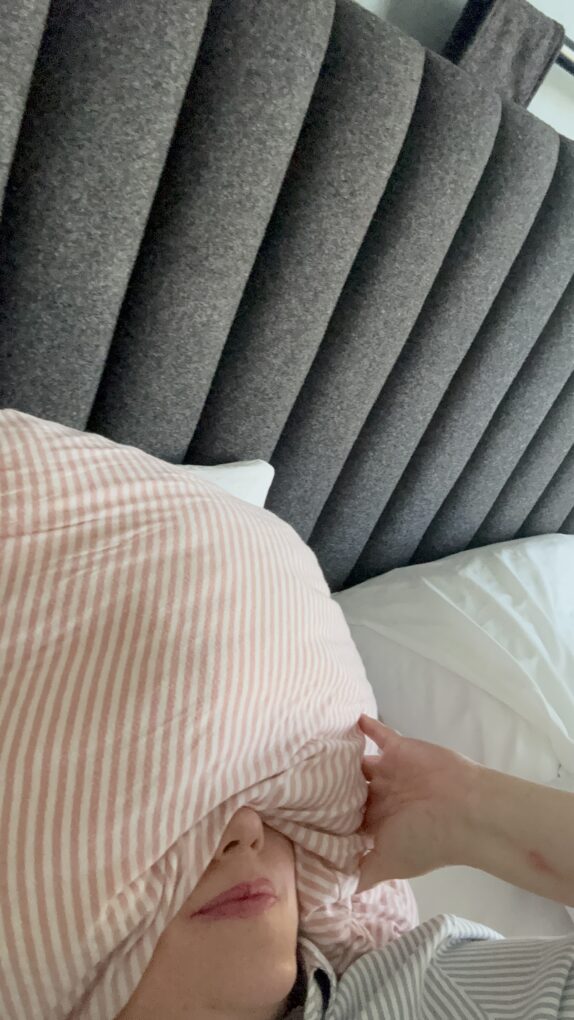 A woman, sleeping on her back, with a Sleep Crown on her face.